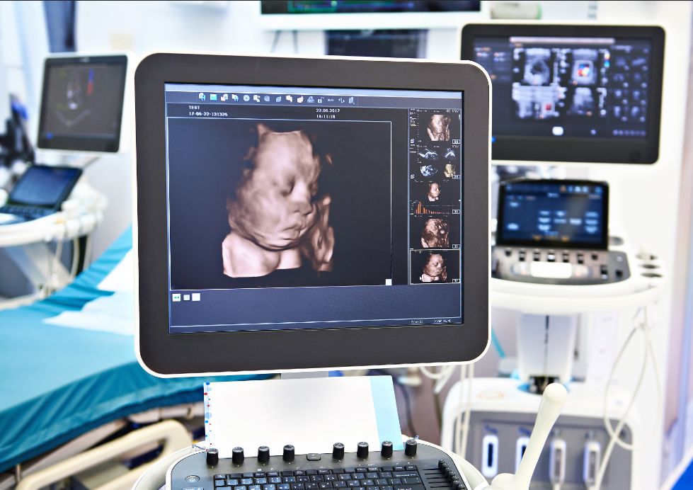 3D Ultrasound